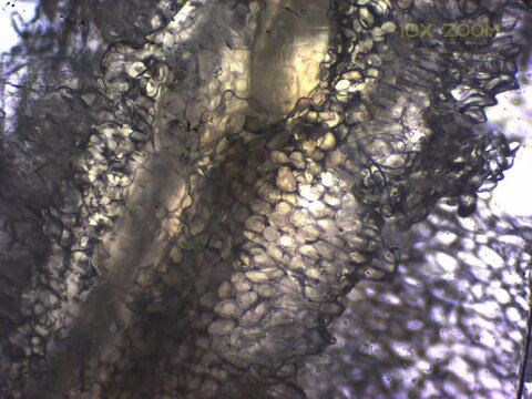 phloem bundles of banana under microscope