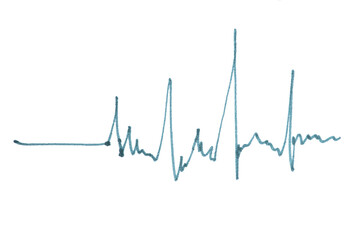Heart beat cardiogram handwriting. Green line template on a white background. Felt-tip pen mark....