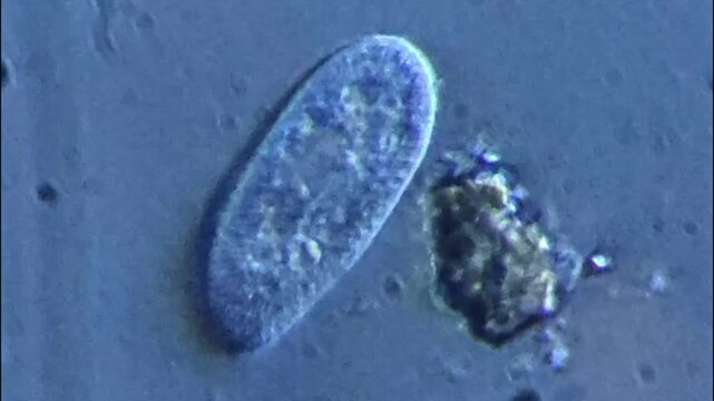 Paramecium with beating cilia an contractile vacuoles