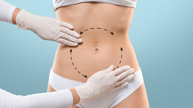 Liposuction Areas Images – Browse 715 Stock Photos, Vectors, and Video | Adobe Stock