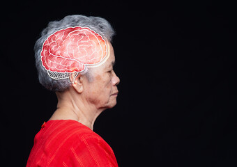 Senior woman in profile with a brain illustration, representing dementia, Alzheimer's disease, and...