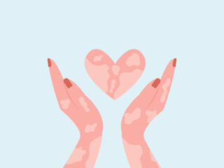 Two hands with suffering from leprosy disease holding heart show care and support. vector illustration