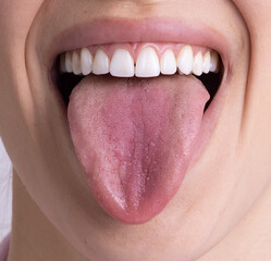 Obraz premium A close-up of a smiling mouth with a pink tongue sticking out, revealing white, well-aligned teeth. The tongue is slightly moist with visible texture, and the model's skin is fair and smooth. 