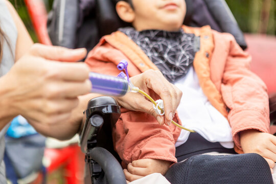 Mother assists her child with feeding tube in wheelchair