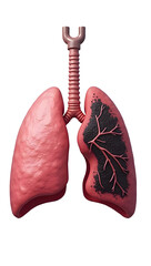 Diseased Lung Concept - Health and Smoking Effects Illustration