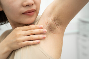 Asian woman have problem black armpit beauty skin care.