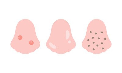 鼻　肌トラブル　イラストセット