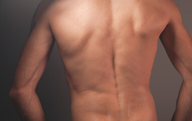 Fototapeta premium young man suffering in the pain. back view.