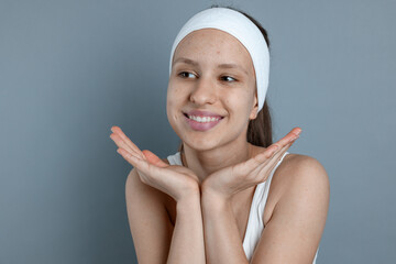 Teenage girl with acne problem on grey background