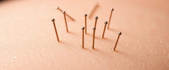 Close-up of acupuncture needles inserted into a skin-like surface, meridian, traditional