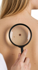 Dermatologist examining mole on woman's back with magnifying glass in clinic. Skin cancer prevention, melanoma awareness, dermatology concept. Ideal for healthcare, medical, and skincare topics