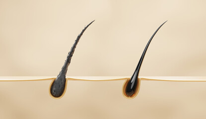 3D illustration of damaged hair vs healthy hair comparison under skin, concept for hair treatment, hair care product, and scalp health.
