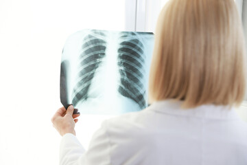 Doctor examining chest x-ray near window in clinic, back view