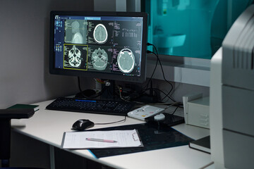 Medical office showcasing computer monitors with detailed scans of human brain, highlighting diagnostic process during examination