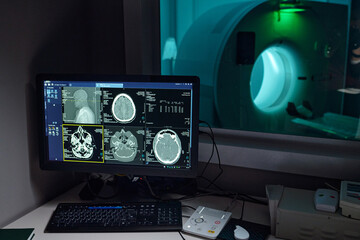 Medical room showing brain MRI scans on computer screen alongside MRI machine. Equipment indicating ongoing imaging and diagnostic procedures in controlled environment