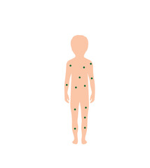 child's body with varicella spots ,on a white background,