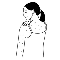 Women get monkey pox