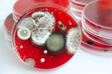 Bacterial and mold fungi colonies grown from indoor air on blood sheep agar