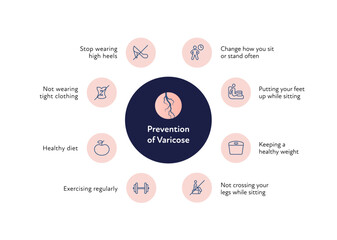 Varicose disease for healthcare infographic. Vector flat chart illustration. Vascular disease diagnostic and treatment. Risk factors chart. Design for education
