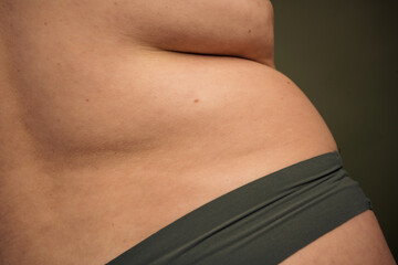 Body positivity and self acceptance: exploring natural beauty and individuality with an unretouched...