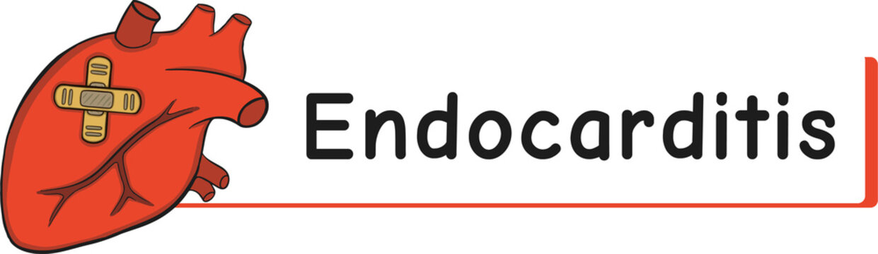heart disease endocarditis