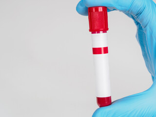 A close-up of a blood collection container, ready for medical testing. Sterile and professional.