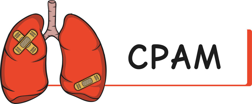 lung disease CPAM