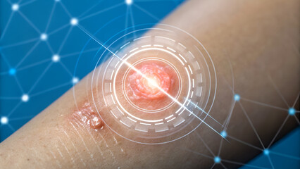 wound care products ointment Innovative illustration of a wound with a digital overlay, symbolizing healing technology.