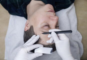A dermatologist takes a skin scraping test for demodicosis and dermatitis, fungal infection....