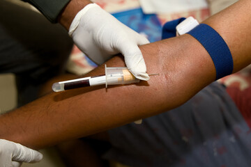 Blood sample collection in a clinical setting for testing
