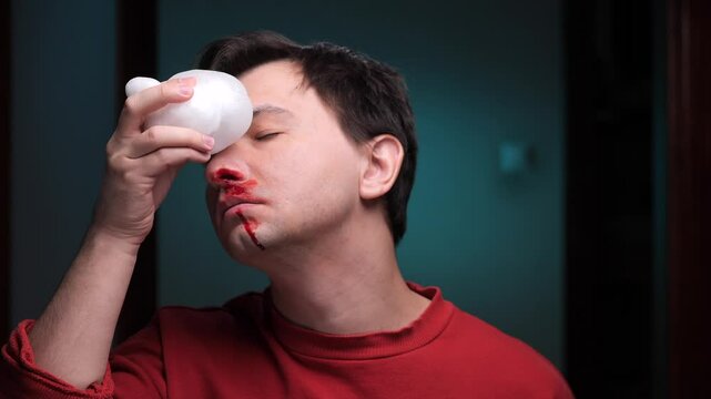 Man using ice pack on nose to stop bleeding after injury