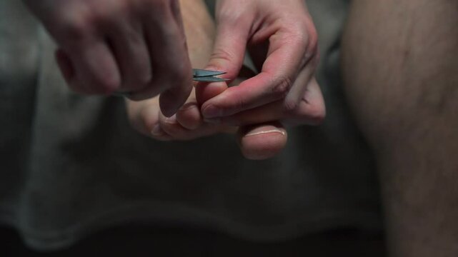 Nail file.
A man files his nails with a nail file.
Pedicure on men's feet.
Foot health.
Feet on feet.
Overgrown nails on a man's foot