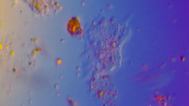 Amoeba endocytosis under DIC microscope-400x