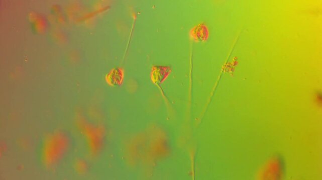 Vorticella retraction-ciliates under DIC microscope-100x