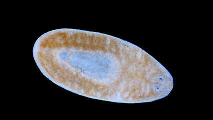 Flatworm Uteriporus vulgaris under a microscope, order Tricladida, Platyhelminthes phylum. Sample...