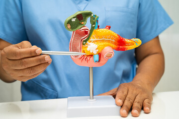 Pancreatitis, pancreatic cancer, Asian doctor with pancreas, gallbladder and bile duct human anatomy model at hospital.