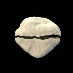 Patella transverse displaced fracture, 3D illustration