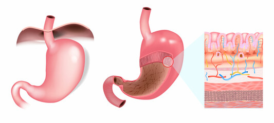 Human Stomach Wall Layers and Surface Mucous Cells. Medical Illustration of Gastric. Anatomy of Stomach Wall. Histological Structure of Stomach Wall and Gastric Glands 