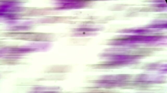 Hematocrit buffy coat blood smear Wright stain under microscopy 
