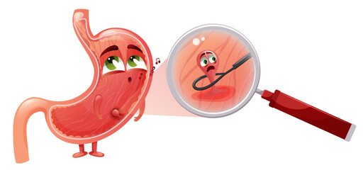 Removal polyp in stomach. Cute funny stomach. Vector illustration