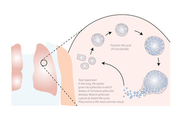 Parasitic life cycle of Coccidioides