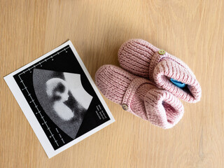 Pink baby booties next to ultrasound image on wooden table, celebrating new arrival, at home