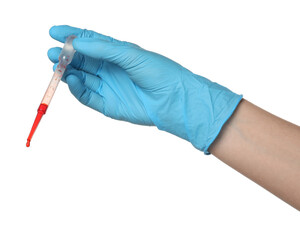 Doctor in medical glove holding pipette with blood sample on white background, closeup
