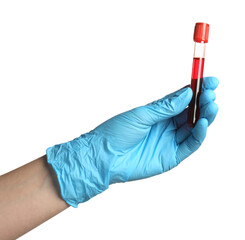 Doctor in medical glove holding test tube with blood sample on white background, closeup
