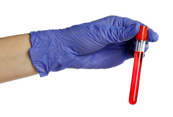 Doctor in medical glove holding test tube with blood sample on white background, closeup