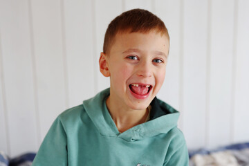 A 7-year-old boy smiles without two front teeth