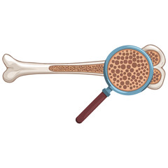 Bone Health Osteoporosis Vector Illustration