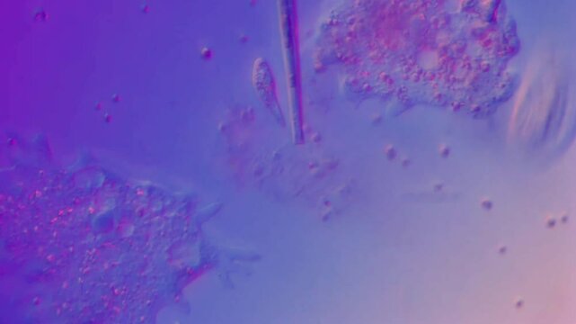 Amoeba Diatom Peranema Flagellate Ciliate in still water-400x magnification DIC microscope, differential interference contrast microscopic footage of aquatic microorganisms in still water, protozoa