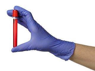 Doctor in medical glove holding test tube with blood sample on white background, closeup