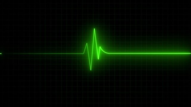 Heart rate monitor electrocardiogram beautiful bright glowing, Health- medicine and human heart concepts.Medical monitor displaying cardiograph pulse checkup.